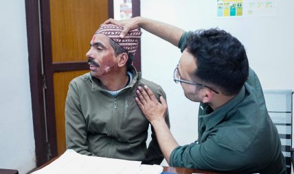 सुर्खेतमा भोलिदेखि ‘नबिल निःशुल्क जलन उपचार शिविर